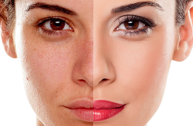 Lý do bôi kem chống nắng mà da vẫn bị sạm đen