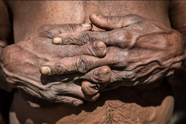 Rùng rợn trước tục lệ 'để tang' của bộ tộc Dani xứ Papua New Guinea