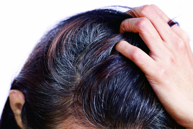Người trẻ có tóc trắng mọc ở 3 vị trí này chứng tỏ gan, thận tổn thương