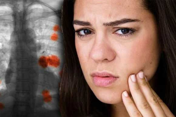 3 dấu hiệu trên cơ thể cho thấy phổi đang tổn thương nặng nề, nhớ nhìn kỹ ngón tay