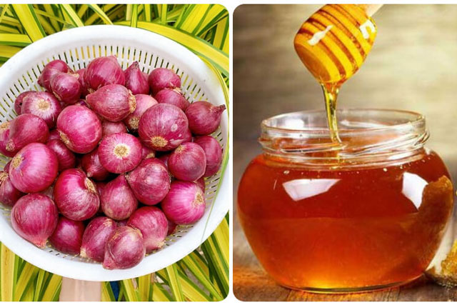 Ho nhiều đến mấy cứ lấy củ hành tím làm theo cách này: Long đờm, sạch phổi, tăng đề kháng cực tốt