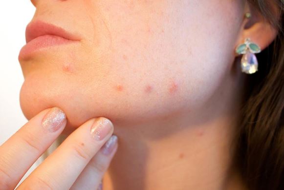 5 dấu hiệu cảnh báo bạn cần thay đổi chế độ ăn uống