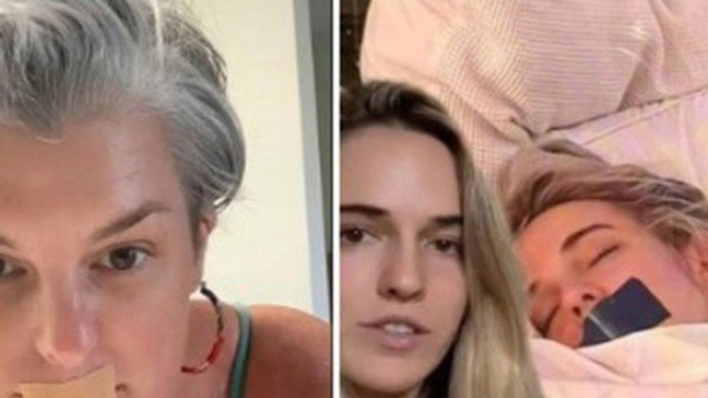 Có nên dán băng dính vào miệng khi ngủ để hạn chế ngáy ngủ? Câu trả lời của chuyên gia gây bất ngờ