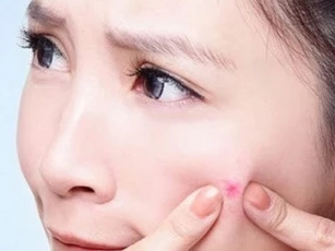 4 không khi chăm sóc da bạn phải nhớ