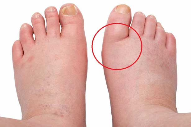 Sáng thức dậy nếu cơ thể xuất hiện những biểu hiện này, chứng tỏ thận đang gặp vấn đề