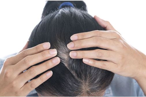 3 cách chữa tóc bạc sớm bạn phải biết