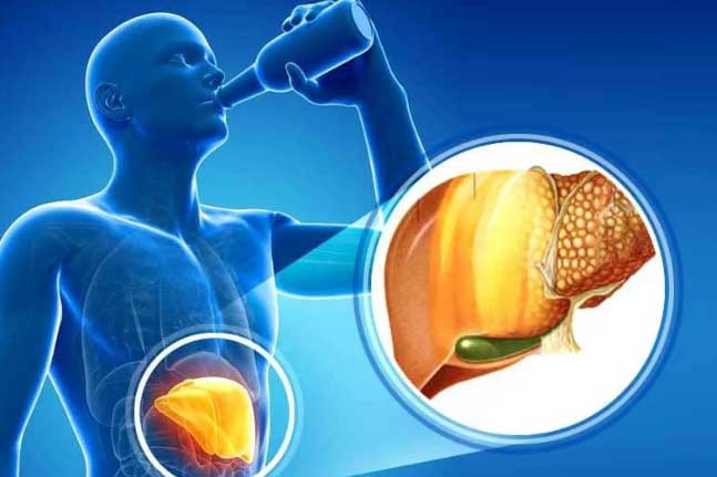 Dấu hiệu cảnh báo gan nhiễm mỡ nặng, nhanh chóng đi khám ngay còn kịp