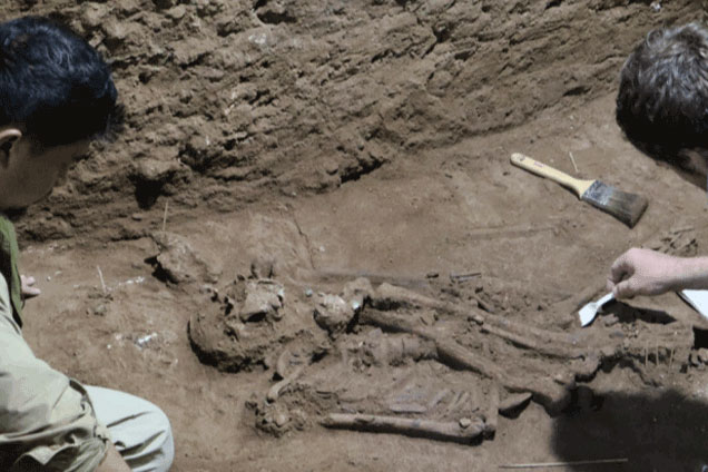 Hài cốt đảo lộn lịch sử ở Indonesia: Ca phẫu thuật sốc 31.000 năm trước