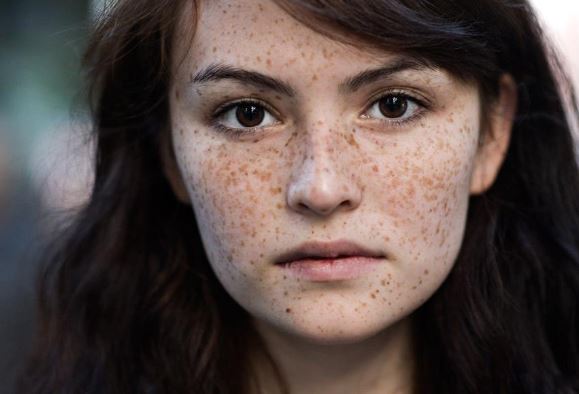 Công thức trị tàn nhang từ thiên nhiên