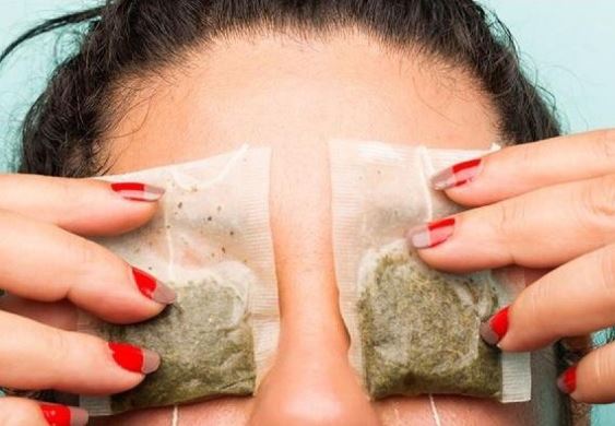 Cách đơn giản giúp bạn loại bỏ thâm quầng cho mắt