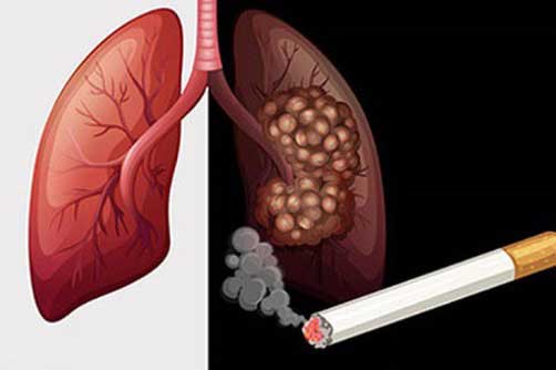 Bí quyết thanh lọc phổi dành riêng cho người hút thuốc lá