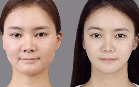 4 cách giảm béo mặt tại nhà bạn phải biết