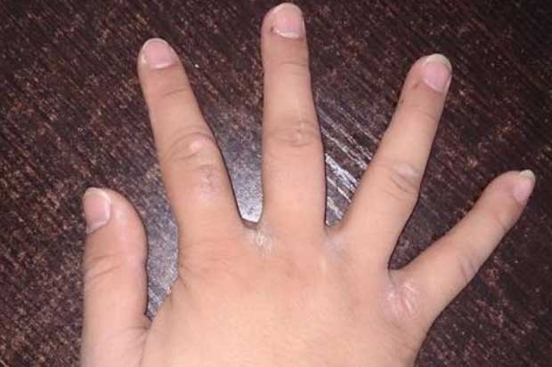 Gan khỏe hay yếu cứ nhìn xuống ngón tay giữa là biết, không có cả 3 dấu hiệu chứng tỏ gan rất tốt