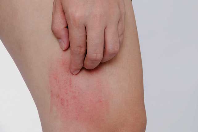 3 chỗ bị ngứa cảnh báo đường huyết tăng cao quá mức, 3 vị trí đau cảnh báo tim gan thận đang gặp nguy