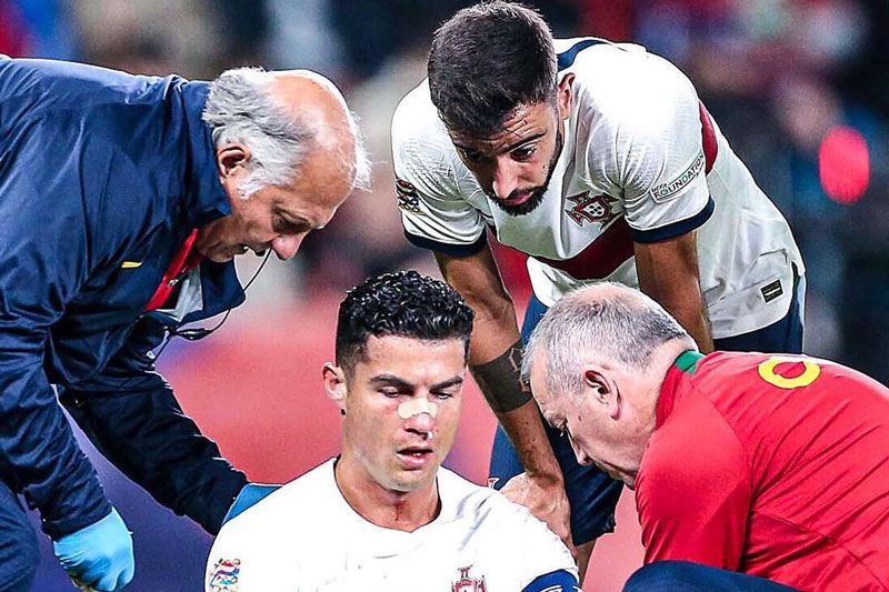 Hậu vỡ mũi, Ronaldo bất ngờ có 'vũ khí bí mật' trước trận derby Manchester