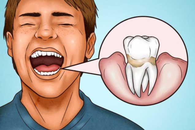 4 dấu hiệu cho thấy bạn đang đánh răng sai cách, làm hỏng răng lợi