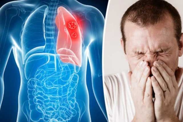 Thấy 5 dấu hiệu này, hãy cảnh giác vì phổi đang "tích độc", nhanh chân đi khám ngay