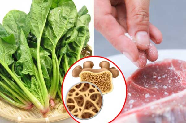 Loại thực phẩm phá hủy xương khớp mỗi ngày, số 1 nhiều người mắc phải mà không hề biết