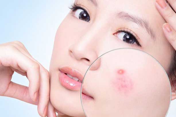 5 dấu hiệu chứng tỏ cơ thể bạn đang thiếu vitamin, canxi trầm trọng, cần bổ sung ngay