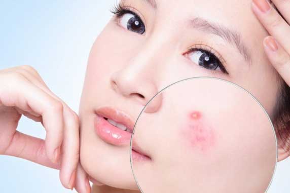 5 thực phẩm khiến da mọc đầy mụn, cơ thể lão hoá nhanh chưa từng thấy, nhiều người Việt vẫn "nghiện"