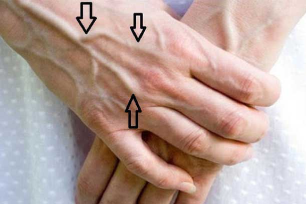 Dấu hiệu trên bàn tay cảnh báo gan đang nhiễm độc, "nhàu nát" từng ngày, nguy hại nhất là số 1