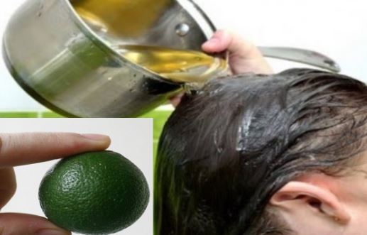 3 cách làm sạch gàu nhanh chóng không mất nhiều thời gian