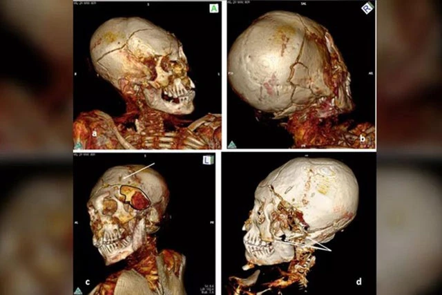 Ảnh chụp CT 3D hộp sọ của một trong những xác ướp Nam Mỹ trong nghiên cứu mới.