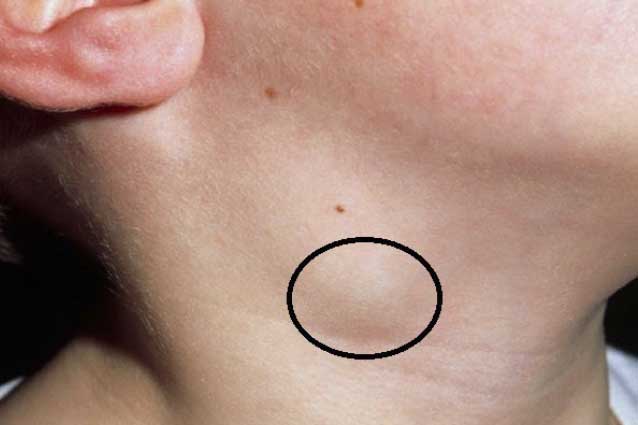 4 bộ phận trên cơ thể 'nhô' ra bất thường cảnh báo bệnh nguy hiểm, chớ dại chủ quan