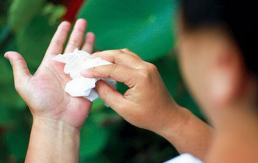 4 cách chữa ra mồ hôi tay bạn cần nhớ