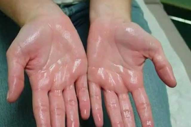 Thấy 4 dấu hiệu này trên cơ thể, hãy đi khám ngay kẻo quá muộn