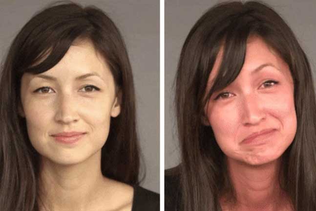 Sau khi uống rượu bia, thấy cơ thể có 4 dấu hiệu này chứng tỏ gan đang tổn thương nghiêm trọng