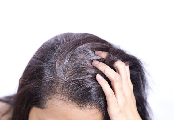 5 bí quyết giúp ngăn ngừa tóc bạc sớm bạn phải biết