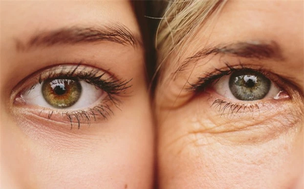 Không dùng kem mắt sẽ làm cho vùng da mắt lão hoá rất sớm. Ảnh minh họa