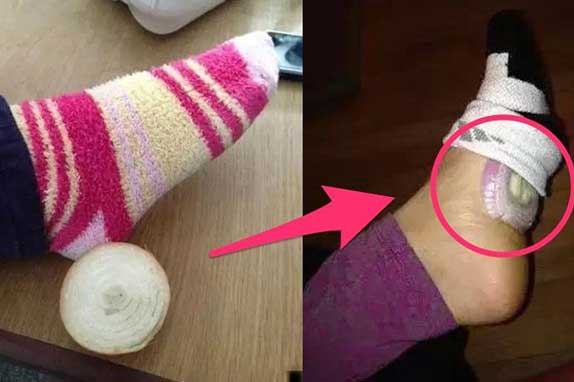 Điều gì sẽ xảy ra với cơ thể nếu để một lát hành tây vào chân khi ngủ?