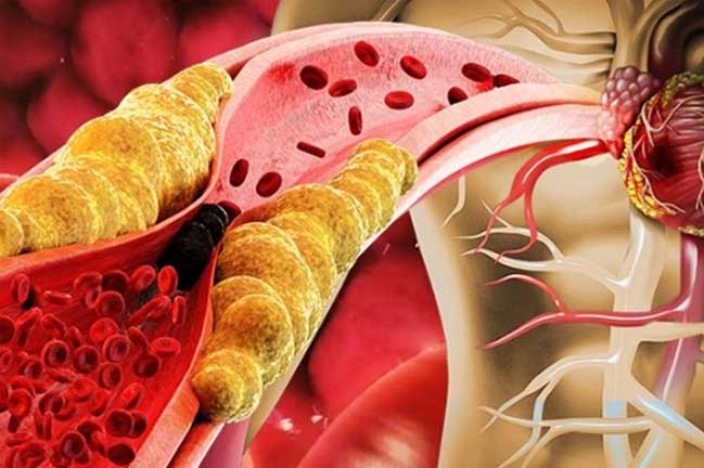 3 phần của cơ thể càng sạch thì tuổi thọ kéo dài, sống bách niên giai lão