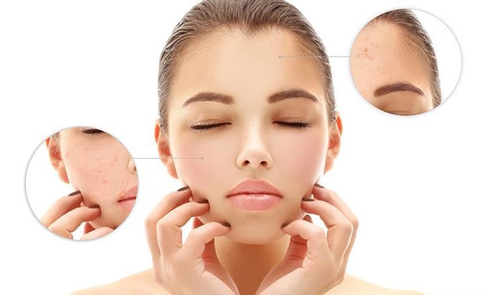 Phụ nữ thông minh không bao giờ làm điều này với da