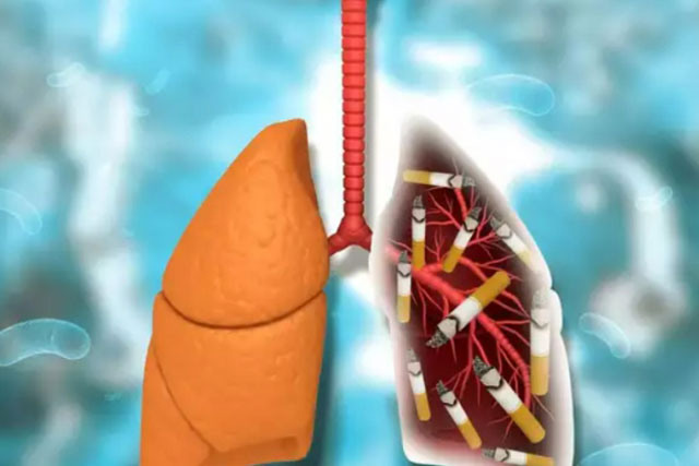 Thực phẩm có thể "cứu" người hút thuốc khỏi tổn thương phổi