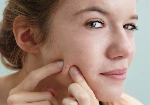 Làn da ngày càng sập xệ vì thói quen không ngờ