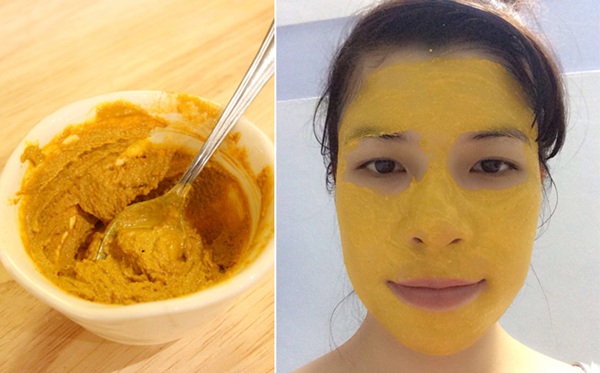 Tiêu diệt mụn trứng cá với công thức vô cùng đơn giản