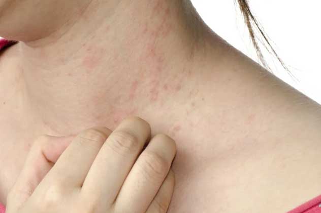 2 chỗ trên cơ thể thường xuyên ngứa ngáy là biểu hiện của bệnh gan, nhiều người tưởng dị ứng