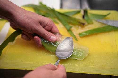 3 cách chữa sẹo bỏng cực đơn giản