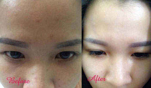 Da trắng hồng rạng rỡ chỉ trong 1 tháng