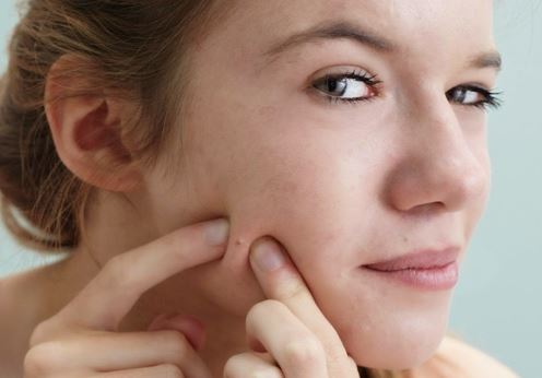 Giải quyết sẹo cực nhanh mà chưa hết 5000 đồng