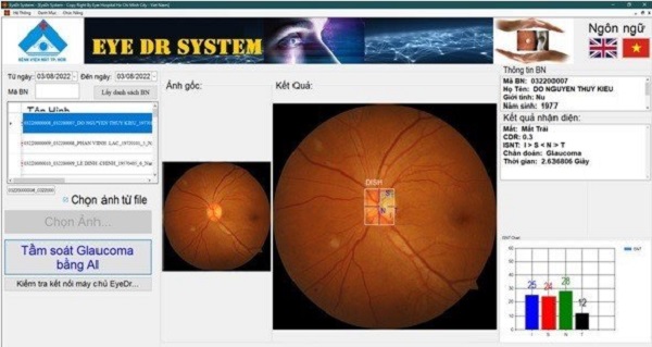 Ứng dụng phần mềm trí tuệ nhân tạo EyeDr để tầm soát bệnh glôcôm 