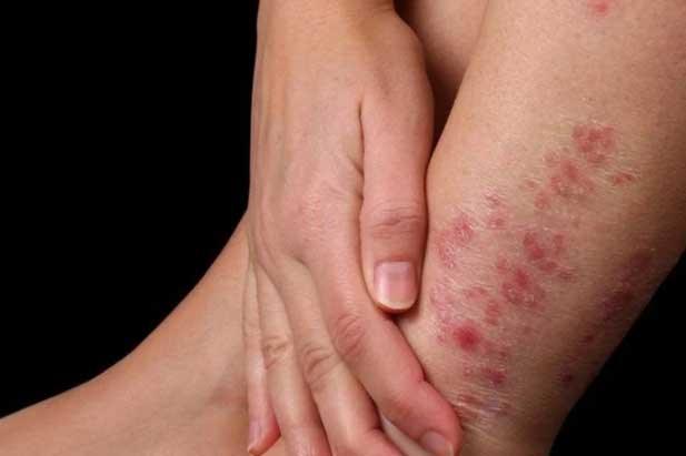 5 vị trí này ngứa thường xuyên cảnh báo bệnh nguy hiểm, chớ chủ quan kẻo hối hận