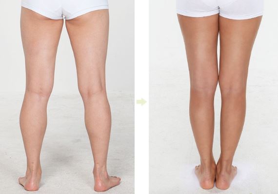 Cách làm giảm mỡ đùi cực dễ mà phụ nữ nên biết