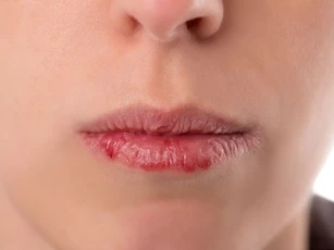 Dấu hiệu bạn cần thải độc cơ thể ngay lập tức