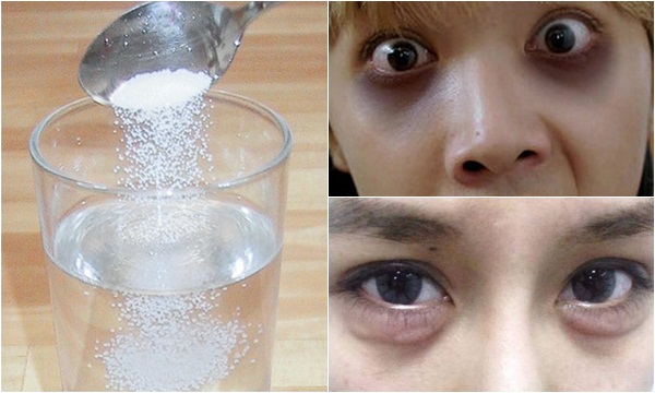 5 công thức thiên nhiên giúp bạn loại bỏ quầng thâm mắt