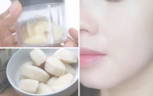 Da bị nám 20 năm cũng khỏi chỉ bằng củ khoai tây