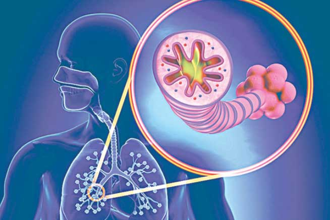 Những dấu hiệu cảnh báo bệnh phổi, nhiều người vẫn chủ quan bỏ qua